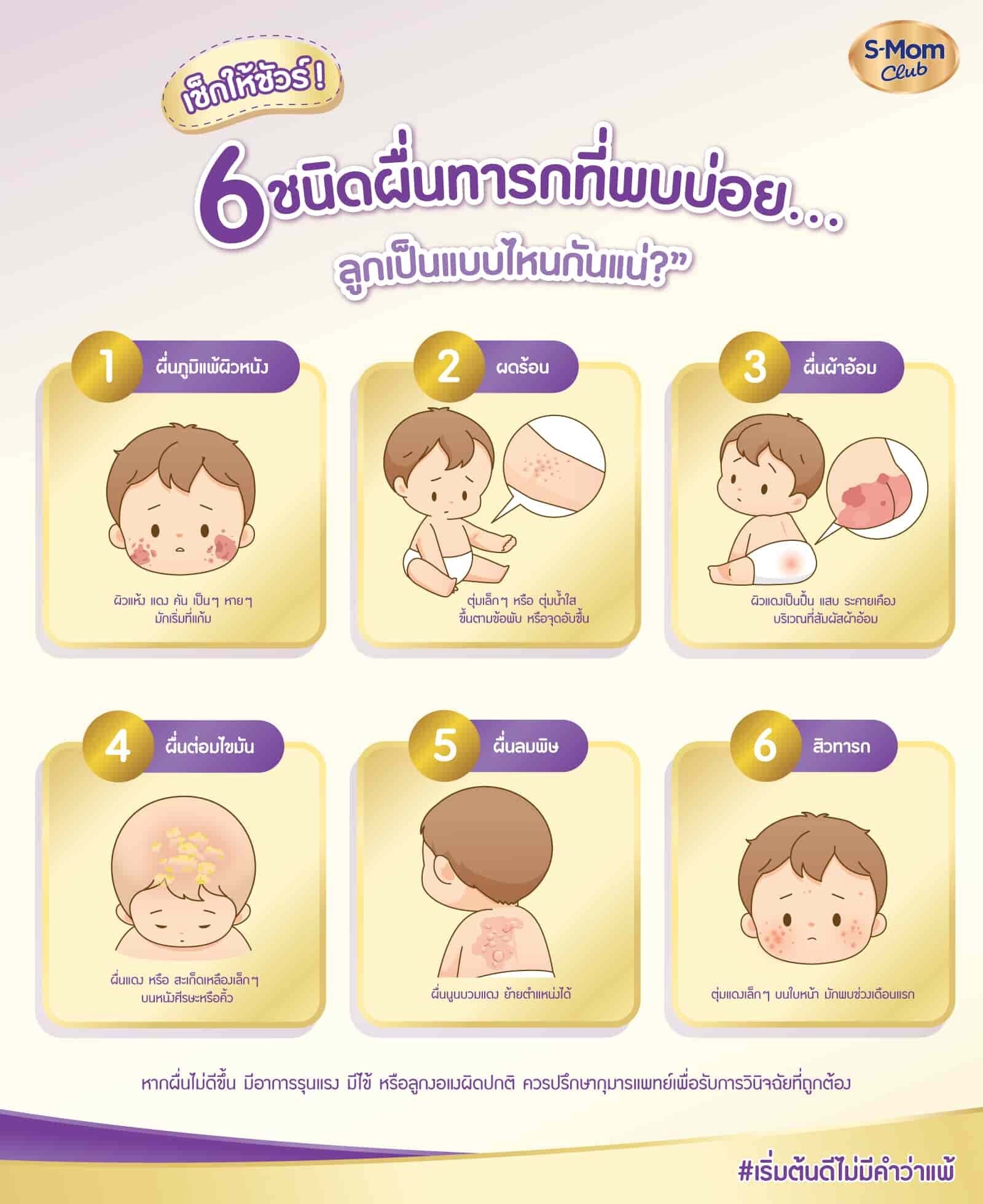ผื่นทารก 6 ชนิดที่พบบ่อย