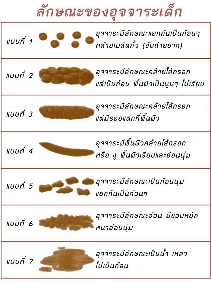 ลักษณะอุจจาระเด็ก เมื่อลูกถ่ายแข็ง ทารกถ่ายแข็ง