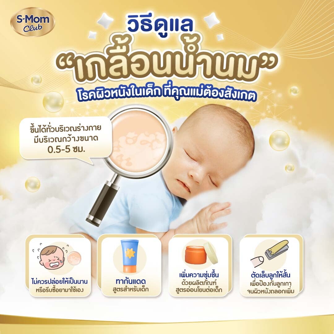 วิธีดูแลเกลื้อนน้ำนมหรือกลากน้ำนม