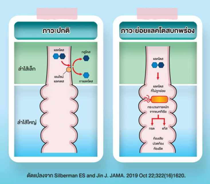 อาการแพ้แลคโตสทารก เกิดจากอะไร พร้อมวิธีป้องกันเมื่อลูกแพ้