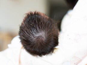 ขวัญบนหัวลูกบอกนิสัย? เด็กสองขวัญ ชายหญิง หมายถึงอะไร