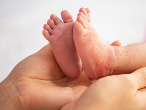 ลูกเป็นผื่นเม็ดเล็ก ๆ คัน สาเหตุที่พบบ่อย พร้อมวิธีรับมือที่ถูกต้อง