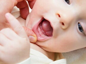 ลิ้นลูกเป็นฝ้าขาว คุณแม่ดูแลลูกลิ้นขาวอย่างไรให้ถูกวิธี