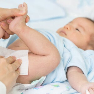 ทารกท้องเสีย อุจจาระทารกท้องเสีย มีลักษณะอย่างไร อันตรายไหม