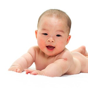 ผื่นแพ้อาหารทารกมีลักษณะอย่างไร รวมวิธีสังเกตและดูลูกน้อย