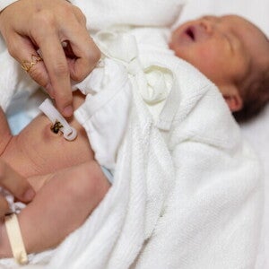 สายสะดือทารก สะดือใกล้หลุดเป็นแบบไหน พร้อมวิธีทำความสะอาด