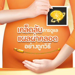 เคล็ดลับการดูแลแผลผ่าคลอดอย่างถูกวิธี เคล็ดลับการดูแลแผลผ่าคลอดอย่างถูกวิธี