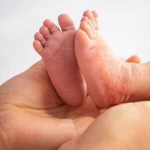 ลูกเป็นผื่นเม็ดเล็ก ๆ คัน สาเหตุที่พบบ่อย พร้อมวิธีรับมือที่ถูกต้อง