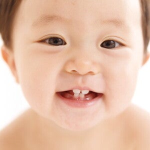 ลำดับการขึ้นของฟันน้ำนมลูก พร้อมช่วงเวลาการขึ้นของฟัน