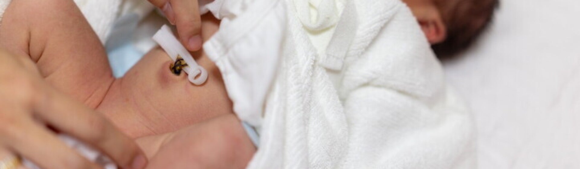 สายสะดือทารก สะดือใกล้หลุดเป็นแบบไหน พร้อมวิธีทำความสะอาด